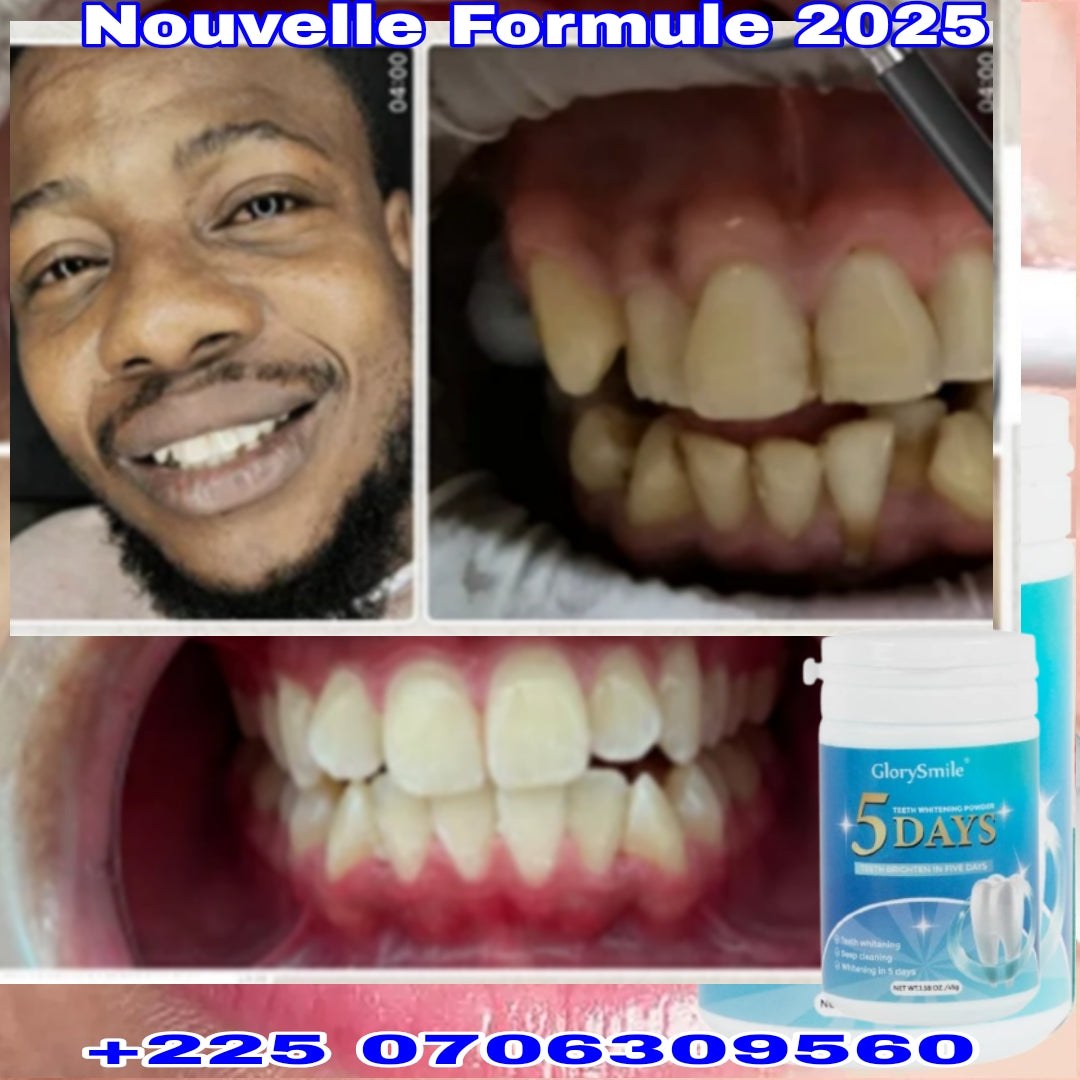 POUDRE DENTIFRICE SOURIR AUX DENTS BLANCHES #2